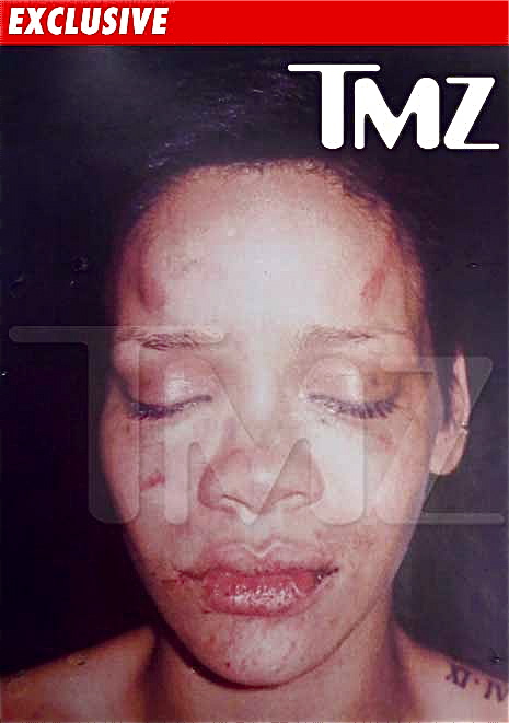 rihanna pictures of chris brown beating. +of+chris+rown+eating